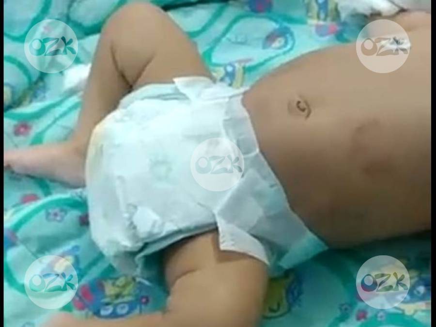 Pai Espanca Filho De Dois Meses Em Sao Fidelis Bebe Sofre Afundamento De Cranio E Socorrido E Internado No Hfm Em Campos Portal Ozk